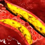 COLESTEROLO-COP-OK-640x382