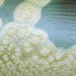 clostridiumb