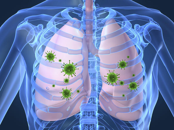 Identificata una proteina chiave coinvolta nella sindrome polmonare da Hantavirus sindrome polmonare da Hantavirus