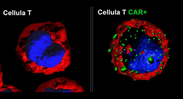 car-t-BG (1)