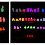 Growing-cells-Autophagy-deficient-cells-crisis-bypass