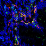 TRM_Zellen_PM_Uni-Klinikum-Erlangen_Sebastian-Zundler-e1548750254371