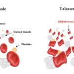 anemia-mediterranea