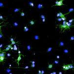 csm_Oligodendrozyten_Staroßom_d83c9c1e89