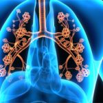 farmaci-asma-allergica