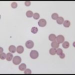 M._haemofelis_IP2011