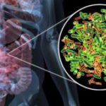microbiota-intestinale-300x169