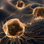 1421940734_cellule-tumorali