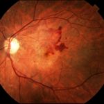 3b44b5000d3ada04c028c395cd05cbfb_XL