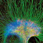 cellule_staminali_neurali_fig_vol1_001950_001