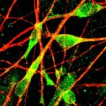 whenneuronsa