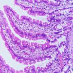 intestinal-villi