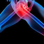 Dolori-Articolari-630x315