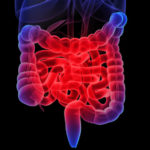 Intestine-768x576