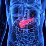 November-Is-Pancreatic-Cancer-Awareness-Month-blog-1024x585
