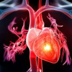 human_heart_attack.jpg_403097445