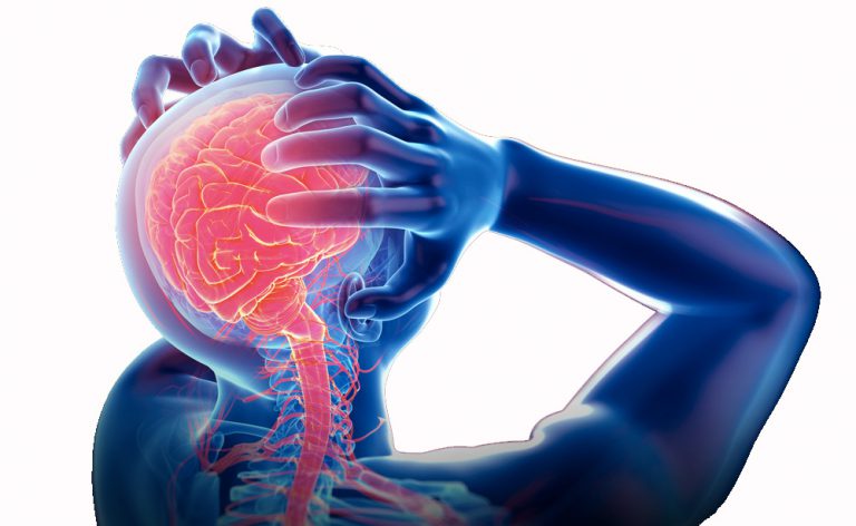Nuova terapia per la cefalea acuta emicrania