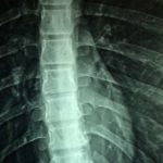 spinalcord