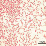 pseudomonasa