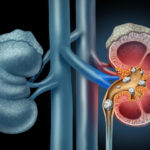 content_ReneSano_Cattivo