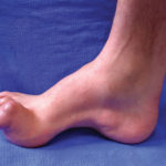 04-La-Charcot-2-web-300x225