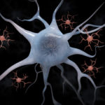 alzheimers-screenshot_forweb-600x441