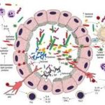 disbiosi-intestinale