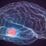 parkinson