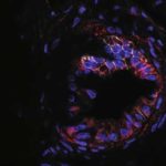 proteincould