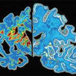 1299860243331_SP_brain-comparison_ksm