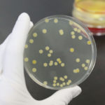 staph-700x467