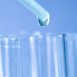 test-delle-urine-glicosuria