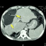 xZlWkNcYXE1eSCm0I2Z7C_thumb_720_480.jpg.pagespeed.ic.VZDZmts0mw