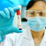 Polmonite-Virale-Cina-Sars-800x500