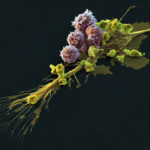 Chimeric Antigen Receptor cells attack cancer, SEM