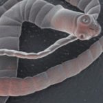 Taenia-solium-la-tenia-di-maiale.jpg_313849946