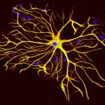 Astrocyte5-e1548789137576