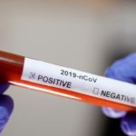 reuters_xix_20200309_194722_009176.JPG?f=detail_558&h=720&w=1280&$p$f$h$w=7c35c1f