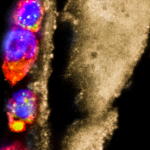 csm_200424_Allergien_Wurmparasiten_Makrophagen_c1c70a0df4