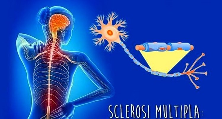 La Sua Buccia E Il Fiocine