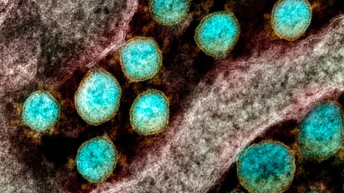 051520_eg_cell-coronavirus_feat-1028x579
