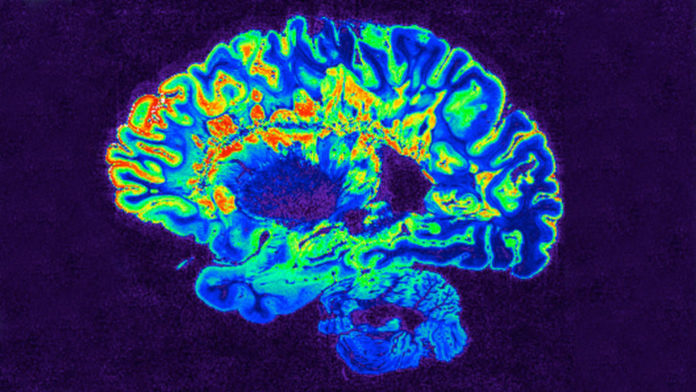 111519_sb_multiple-sclerosis_feat-1028x579