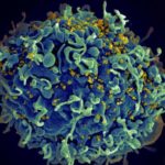 hiv