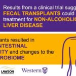 1-fecaltranspl