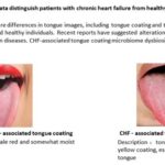Healthy controls vs CHF tongues_jp 4