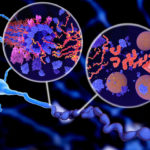 iStock-1046071698_alzheimers_ Tau proteins