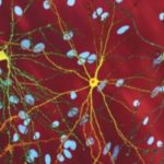 neuron_with_mhtt_inclusion8x5_0