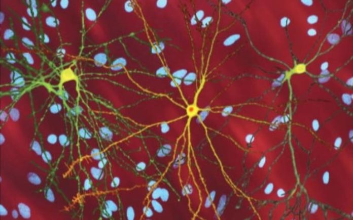 neuron_with_mhtt_inclusion8x5_0