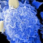 3-cancer (1)