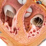 In-che-modo-il-calcio-nelle-arterie-coronarie-pu-predire